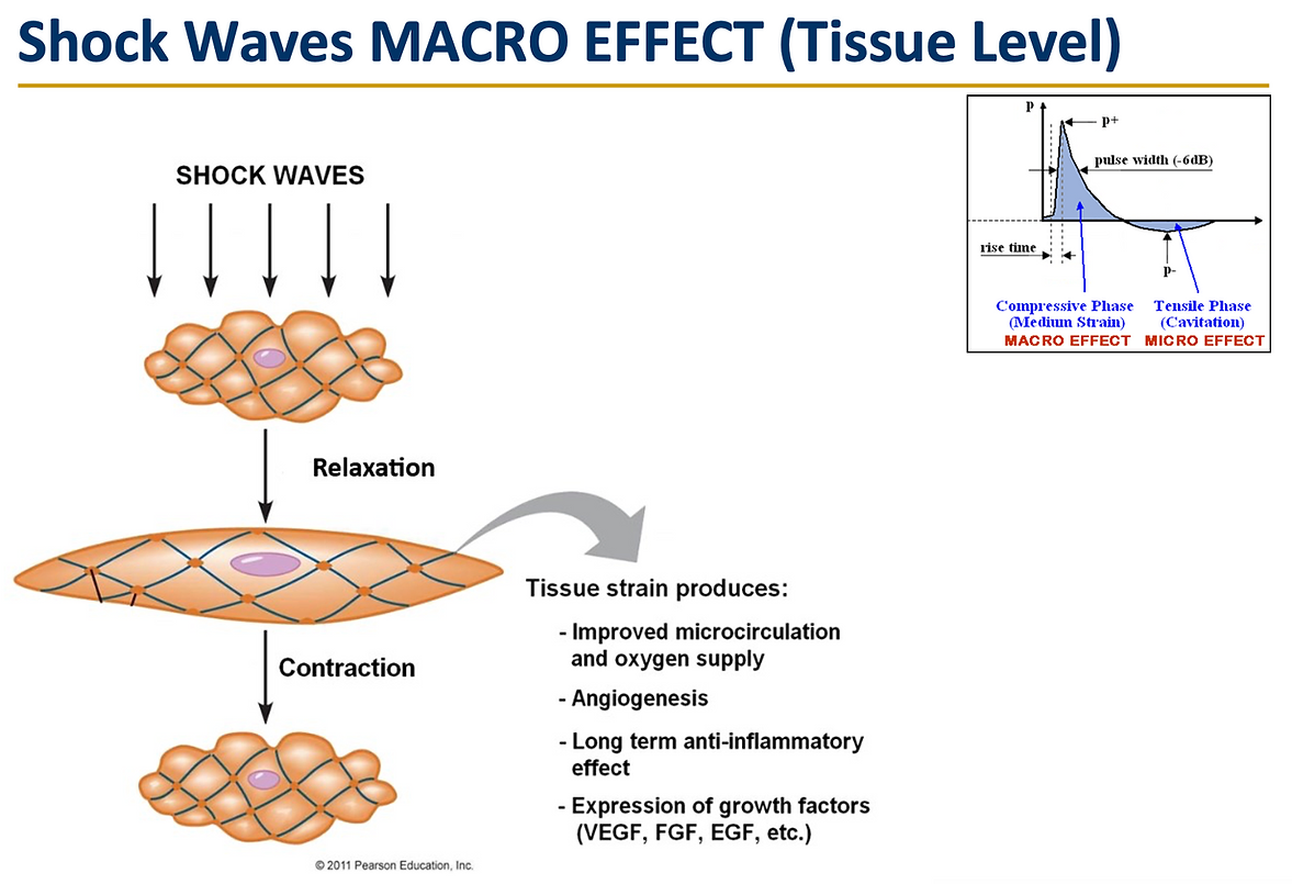 Technology4 - Shock Waves Macro Effect